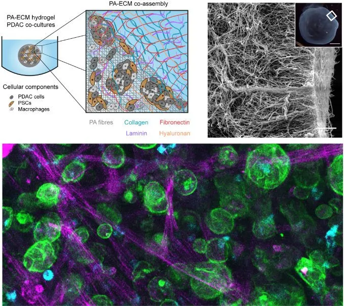 Illustration for: Bioengineered 3D models of human pancreatic cancer recapitulate in vivo tumour biology